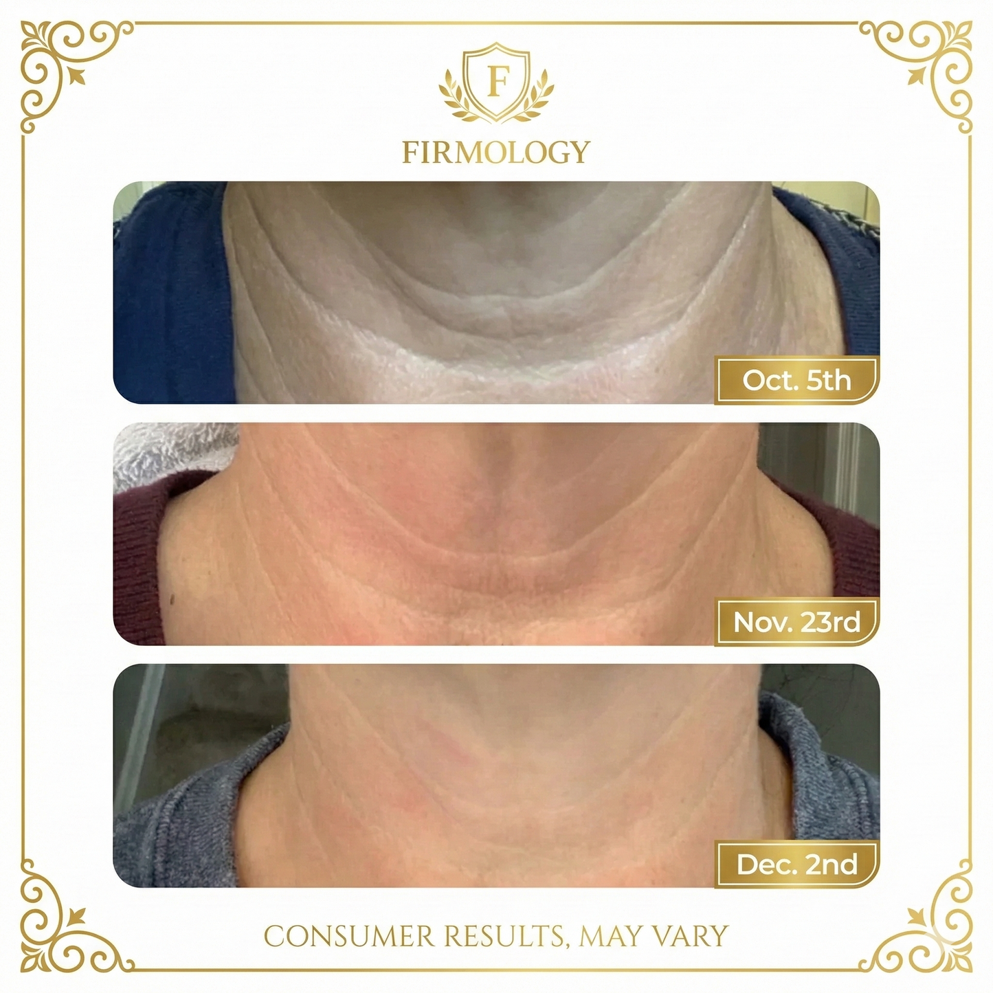 Firmology™ Stretch Marks & Firming Cream