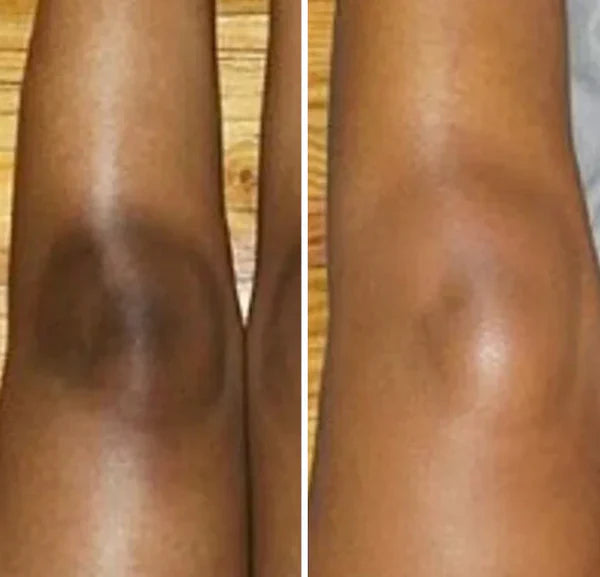 Dr. Melaxin Peel Shot: Brightening Body Spray