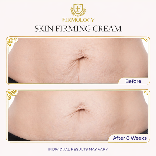 Firmology™ Stretch Marks & Firming Cream