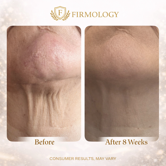 Firmology™ Tighten & Lift Neck Cream