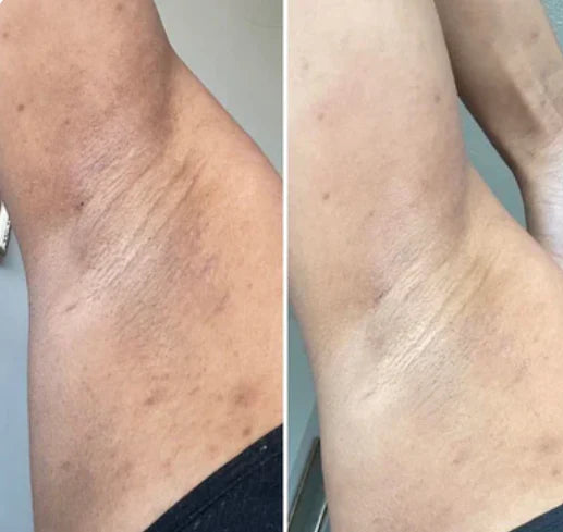 Dr. Melaxin Peel Shot: Brightening Body Spray
